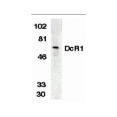 ProSci 2179 DcR1 Antibody
