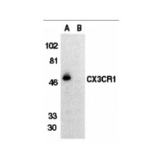 ProSci 2201 CX3CR1 Antibody