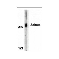 ProSci 2217 Acinus Antibody