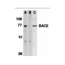 ProSci 2253 BACE Antibody