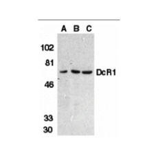 ProSci 2299 DcR1 Antibody