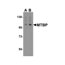 ProSci 2447 MTBP Antibody