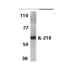 ProSci 2471 IL-21 Receptor Antibody