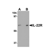 ProSci 2497 IL-22 Receptor Antibody