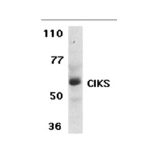 ProSci 2499 CIKS Antibody