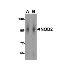 ProSci 2511 NOD2 Antibody