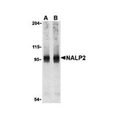 ProSci 3027 NALP2 Antibody