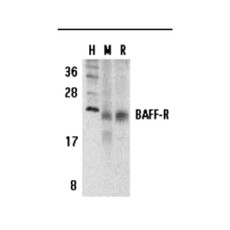 ProSci 3097 BAFF Receptor Antibody