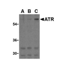 ProSci 3119 ATR Antibody