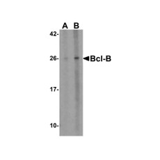 ProSci 3163 Bcl-B Antibody