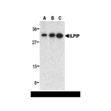 ProSci 3201 ILPIP Antibody