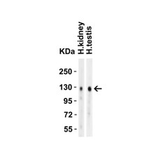 ProSci 3229 ACE2 Antibody
