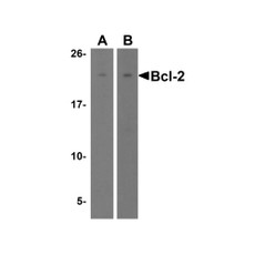 ProSci 3337 Bcl-2 Antibody