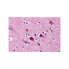 ProSci 3357 BOK Antibody