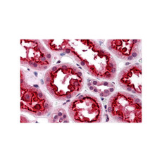ProSci 3391 TAB3 Antibody