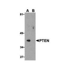 ProSci 3515 PTEN Antibody