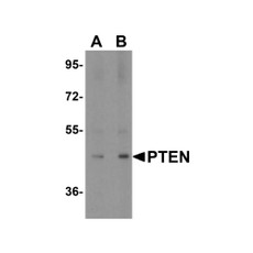 ProSci 3517 PTEN Antibody