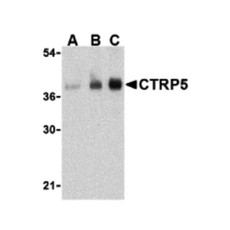 ProSci 3571 CTRP5 Antibody