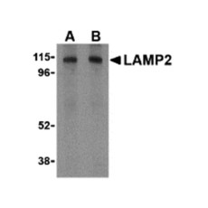 ProSci 3627 LAMP-2 Antibody