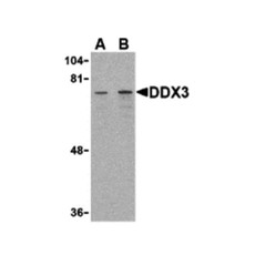 ProSci 3759 DDX3 Antibody