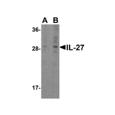 ProSci 3797 IL-27 Antibody