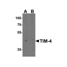 ProSci 3815 TIM-4 Antibody