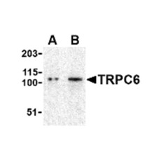 ProSci 3899 TRPC6 Antibody
