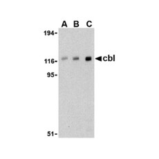 ProSci 3967 Cbl Antibody