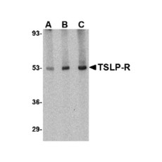 ProSci 4207 TSLP Receptor Antibody
