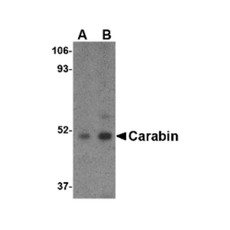 ProSci 4267 Carabin Antibody