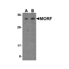 ProSci 4275 MORF4 Antibody