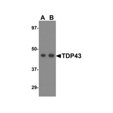 ProSci 4285 TDP43 Antibody