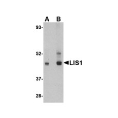 ProSci 4287 LIS1 Antibody