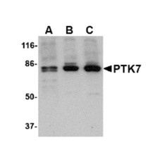 ProSci 4299 PTK7 Antibody