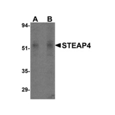 ProSci 4313 STEAP4 Antibody