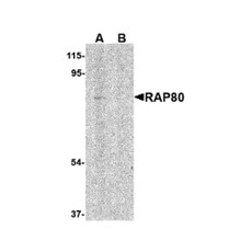 ProSci 4327 RAP80 Antibody