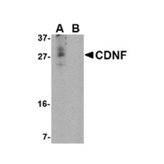 ProSci 4345 CDNF Antibody