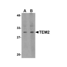 ProSci 4361 TEM2 Antibody