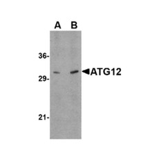 ProSci 4421 ATG12 Antibody