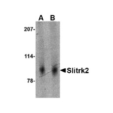 ProSci 4459 Slitrk2 Antibody