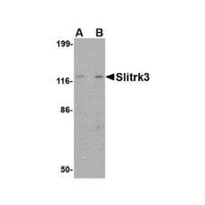 ProSci 4461 Slitrk3 Antibody