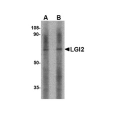 ProSci 4533 LGI2 Antibody