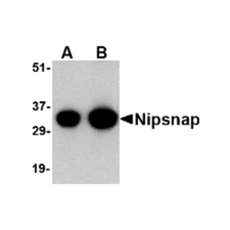 ProSci 4535 NIPSNAP Antibody
