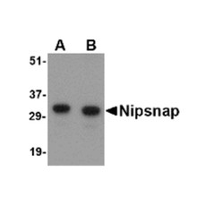 ProSci 4537 NIPSNAP Antibody