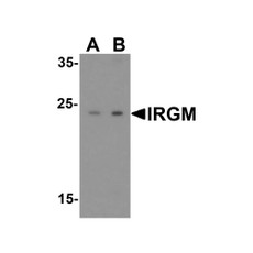 ProSci 4545 IRGM Antibody