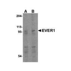ProSci 4549 EVER1 Antibody