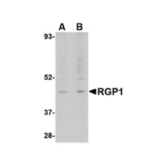 ProSci 4569 RGP1 Antibody