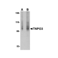 ProSci 4599 TNPO3 Antibody