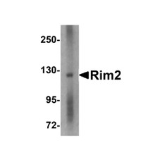 ProSci 4609 Rim2 Antibody