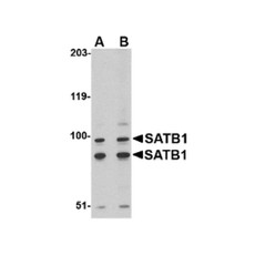 ProSci 4631 SATB1 Antibody